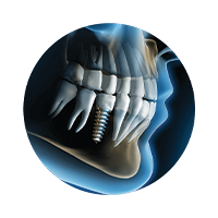 the dental implant centre